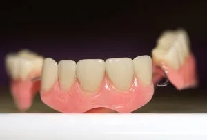 Dental Bridges vs Dental Implants: Which Option is Right for You? 1 Dental prosthesis on dark background